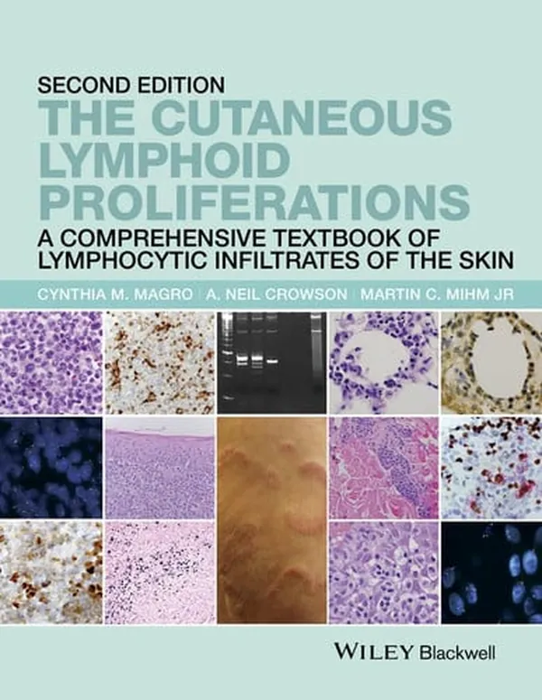 Cover of The Cutaneous Lymphoid Proliferations A Comprehensive Textbook of Lymphocytic Infiltrates of the Skin