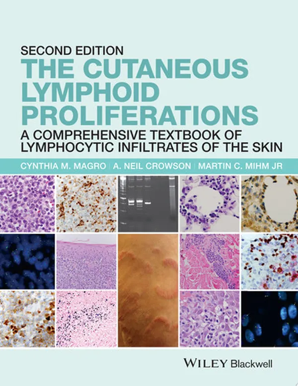 Cover of The Cutaneous Lymphoid Proliferations A Comprehensive Textbook of Lymphocytic Infiltrates of the Skin