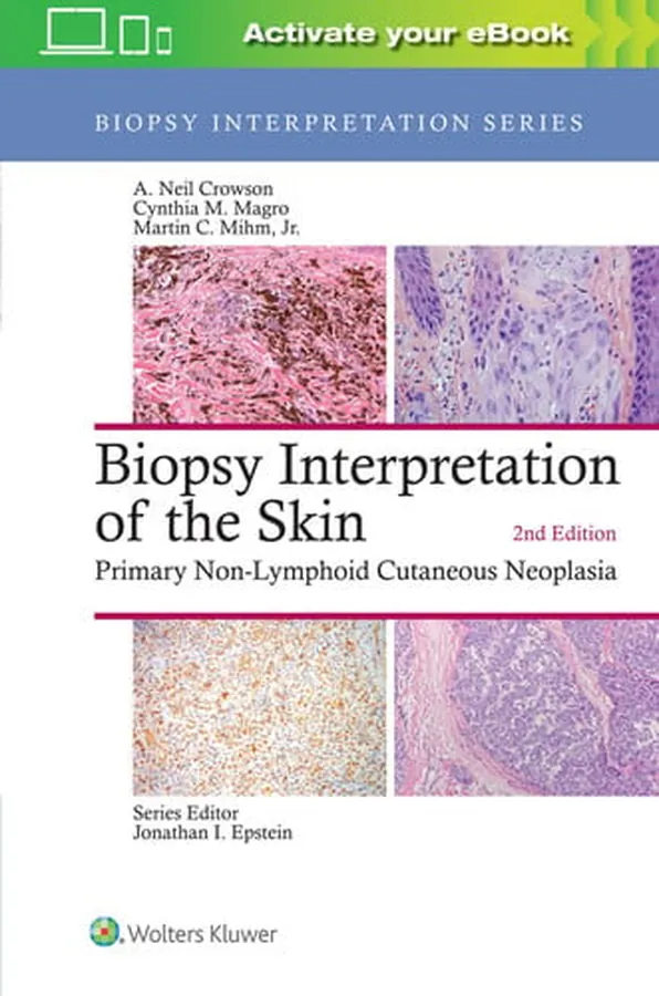 Cover of Biopsy Interpretation of the Skin Primary Non-Lymphoid Cutaneous Neoplasia