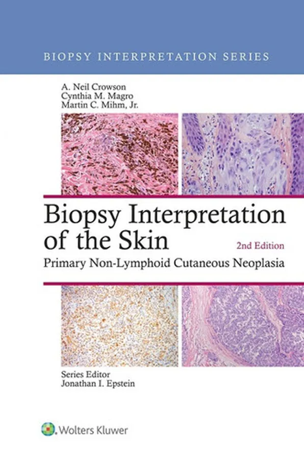 Cover of Biopsy Interpretation of the Skin